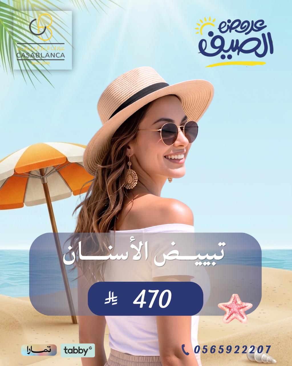 تبييض الأسنان 